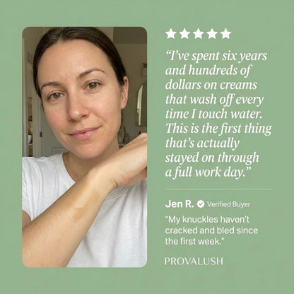Eczema Protection Roll