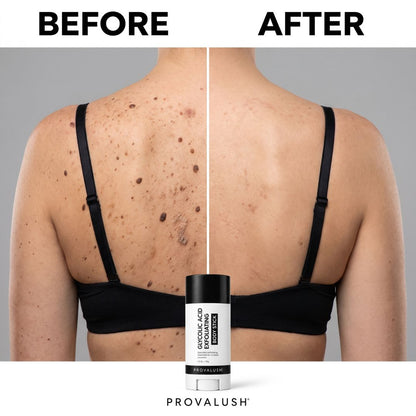 Glycolic Acid Body Stick