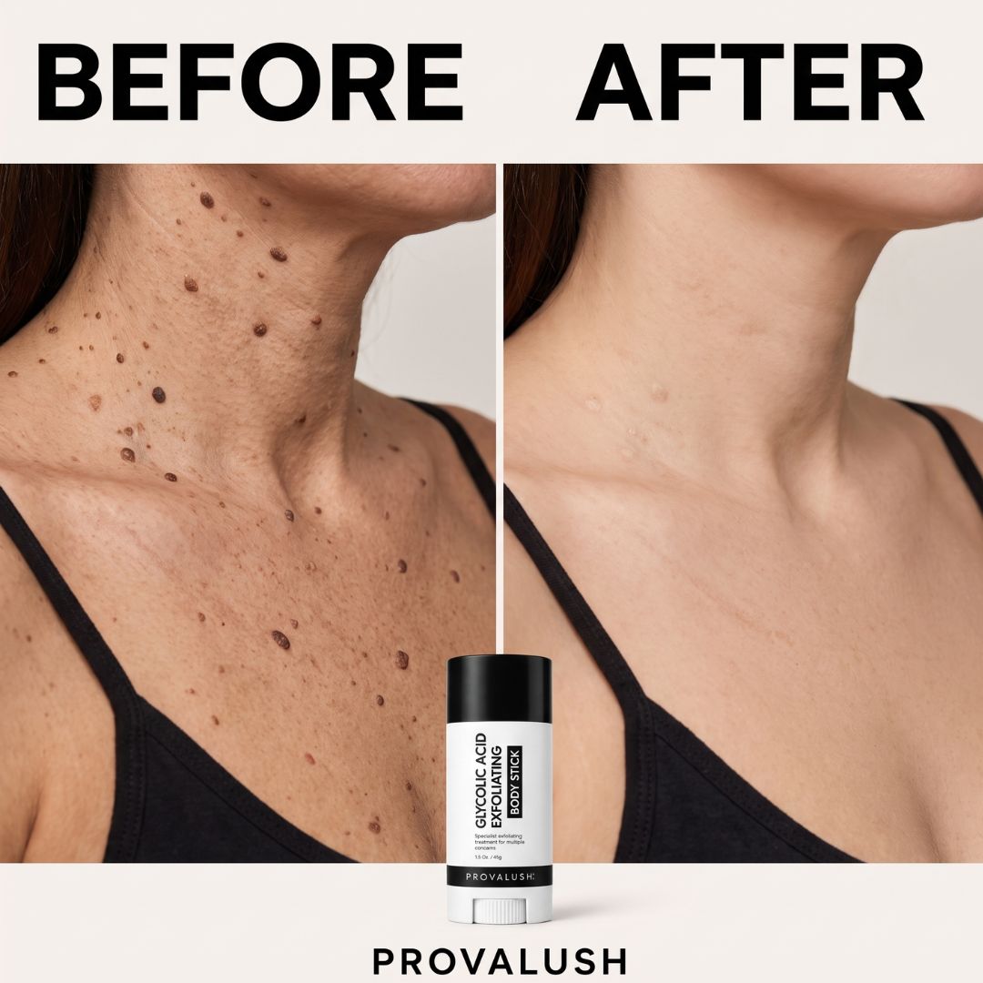 Glycolic Acid Body Stick